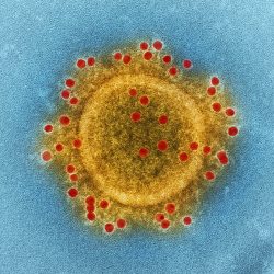 IAM Canada Statement on COVID-19 (Coronavirus)